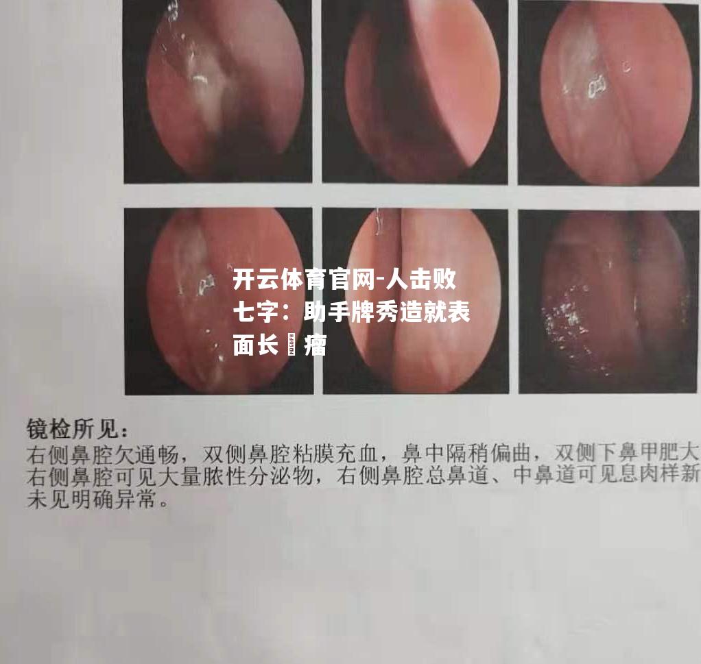 人击败七字：助手牌秀造就表面长膿瘤